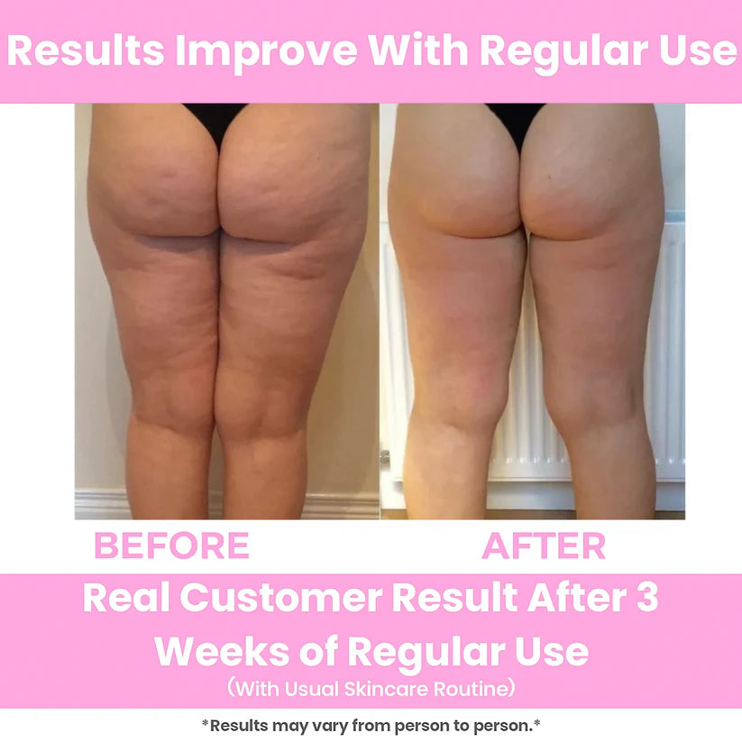 Celessa - Deep Tissue Massage Roller