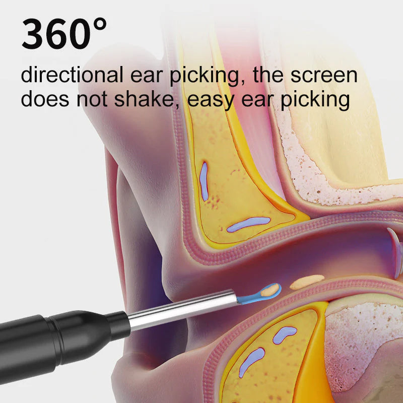ClearScope - Visual Smart Ear Cleaner