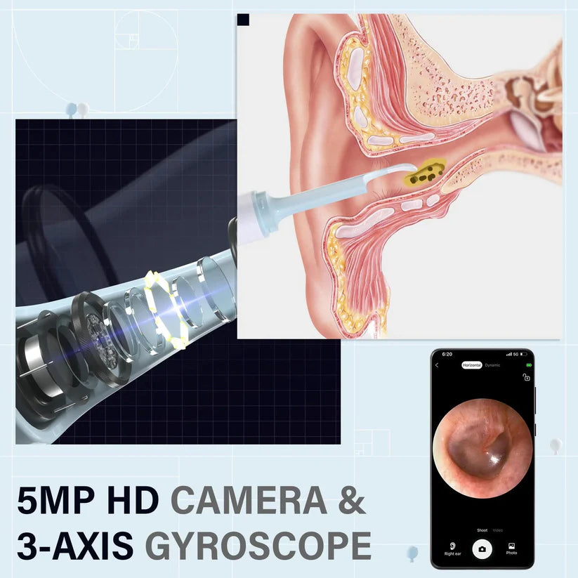ClearScope - Visual Smart Ear Cleaner