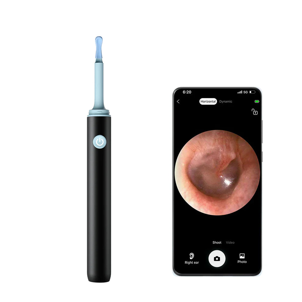 ClearScope - Visual Smart Ear Cleaner